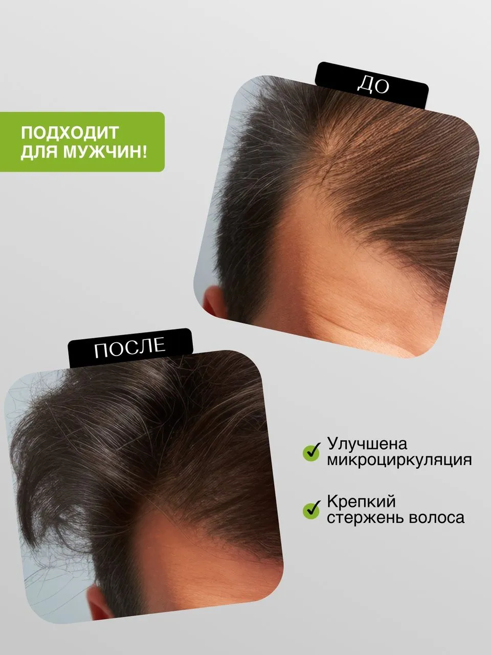 Лосьон-активатор и стимулятор роста волос для кожи головы Tashe professional, 100 мл