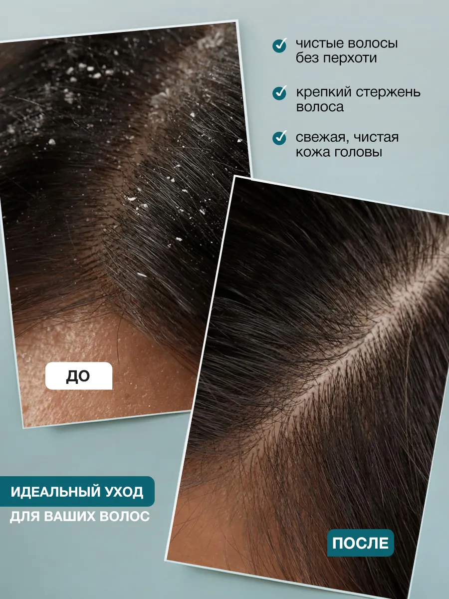 Шампунь для кожи головы Scalp cleansing gel shampoo Tashe professional, 300 мл